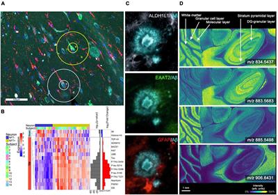Untangling Alzheimer’s disease with spatial multi-omics: a brief review